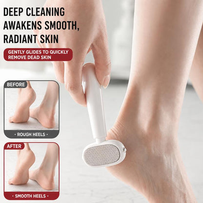SmoothHeel™ Callus Remover Dual-Sided • Removes Dead Skin • Smooths Rough Heels